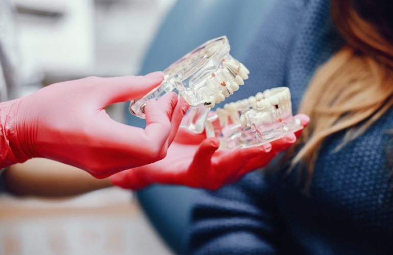 بدائل زراعة الاسنان