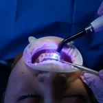 Laser Teeth Whitening in Egypt Types and Benefits by Zakaria dental clinic