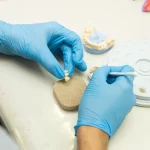 Dental Implant Cost in Egypt Save More Without Sacrificing Care