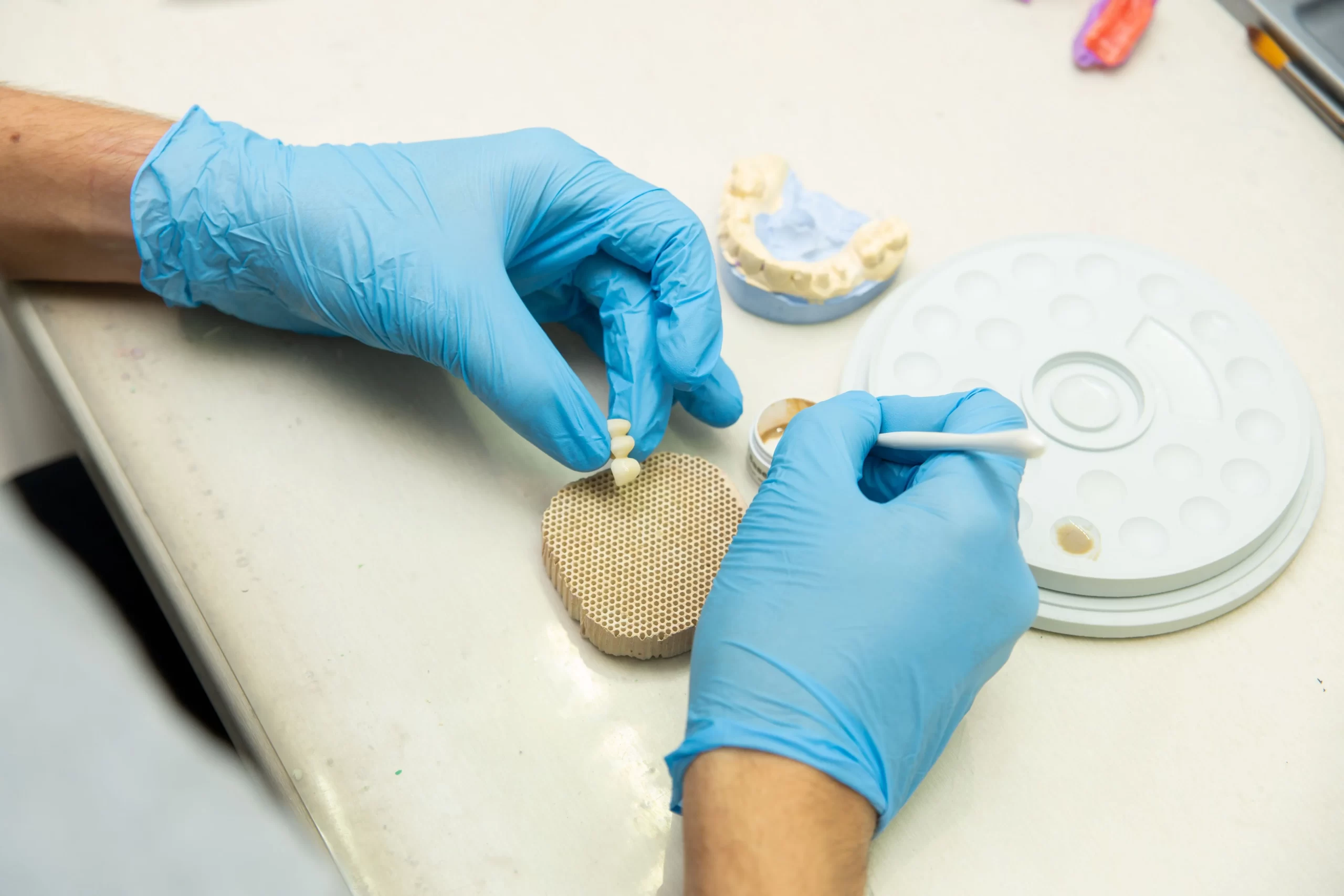 Dental Implant Cost in Egypt Save More Without Sacrificing Care